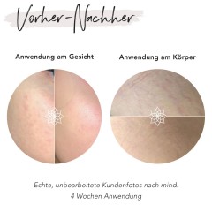 FACES OF FEY Dermaroller 0,25mm Ролик для кожи 0,25 мм